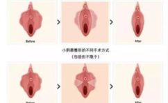 私密肥大图片对比,揭秘变化背后的秘密